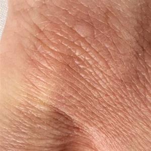 Skin Barrier Repair at Week 6: What Real Progress Looks Like Close-up of hand skin showing improved texture after six weeks of ceramide barrier repair